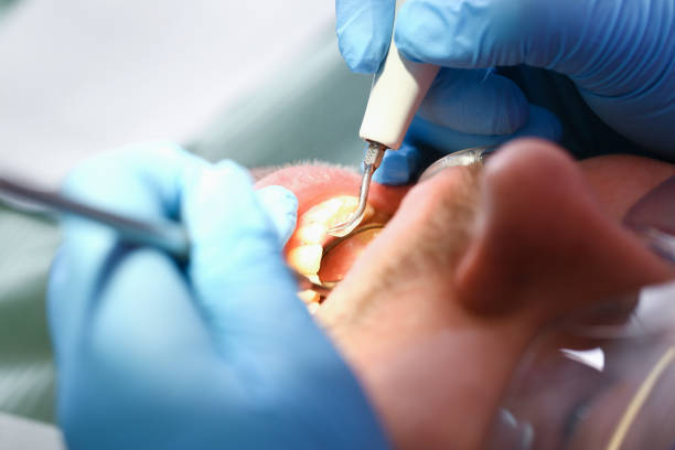 Best Emergency TMJ Treatment in Clay, KY